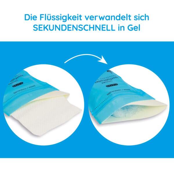 Die Flüssigkeit im Urinbeutel verwandelt sich in Gel