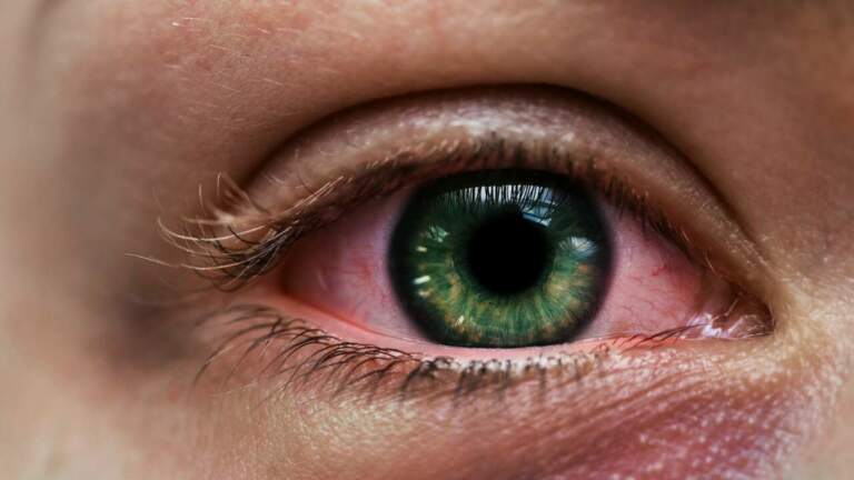 Fremdkörper Im Auge Was Tun flexeo.shop