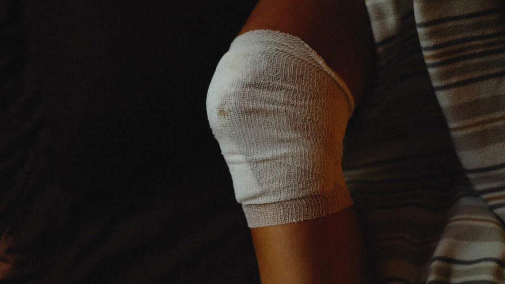 Ein Knie mit einem Verband in einer Decke eingewickelt um 